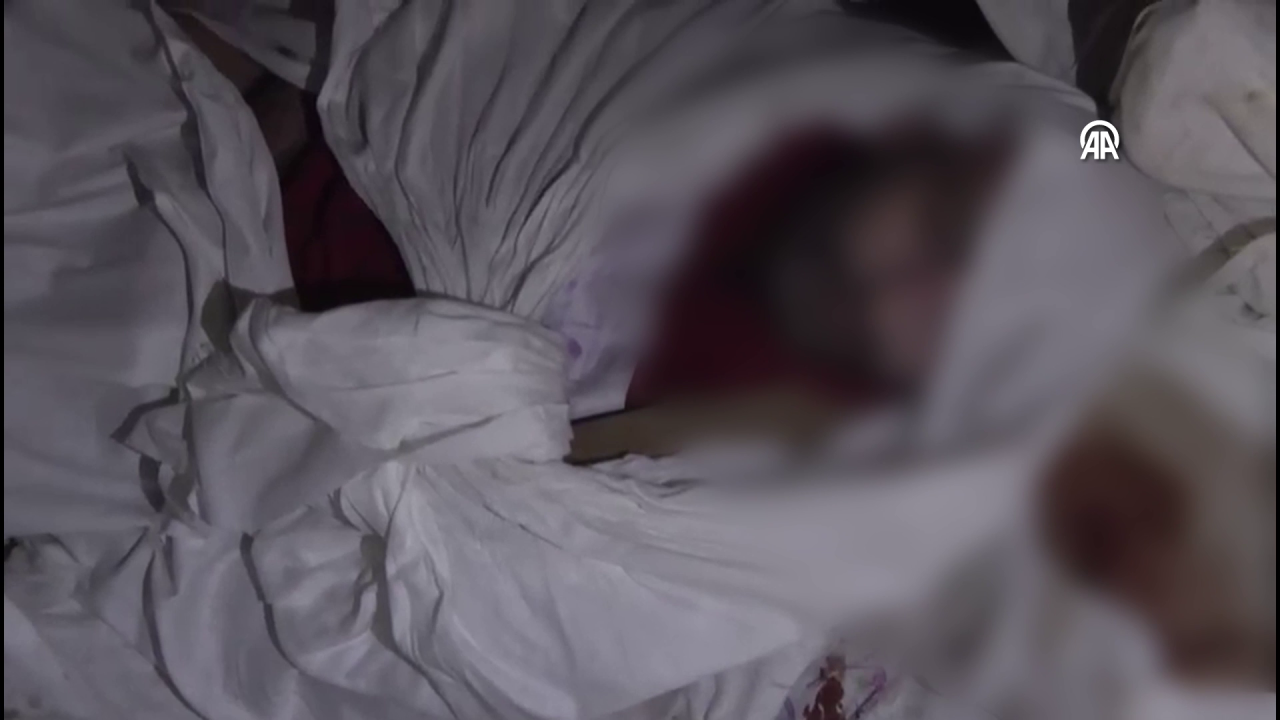 Esad'ın gerçek yüzünü AA görüntüledi! Her karesi kan donduruyor! İşkence ile böyle öldürüldüler 3