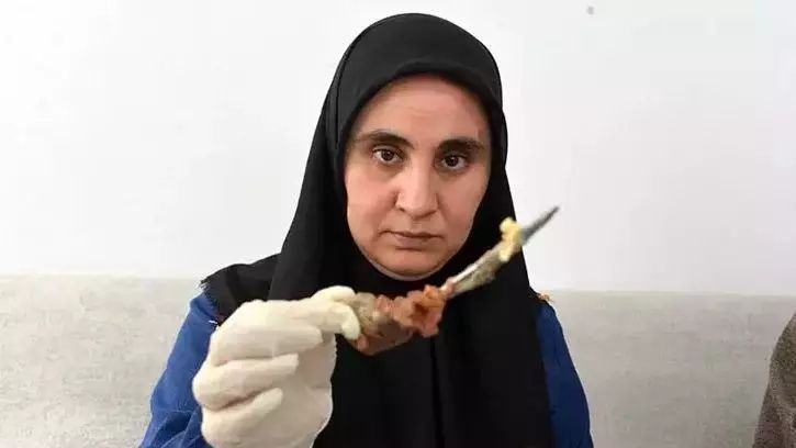 Baş ağrısı şikayetiyle hastaneye gitti, hayatının şokunu yaşadı! Görmeden inanamadı! 4