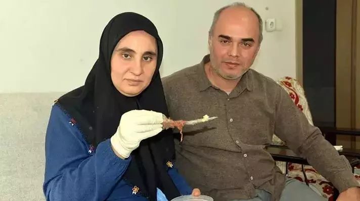 Baş ağrısı şikayetiyle hastaneye gitti, hayatının şokunu yaşadı! Görmeden inanamadı! 2