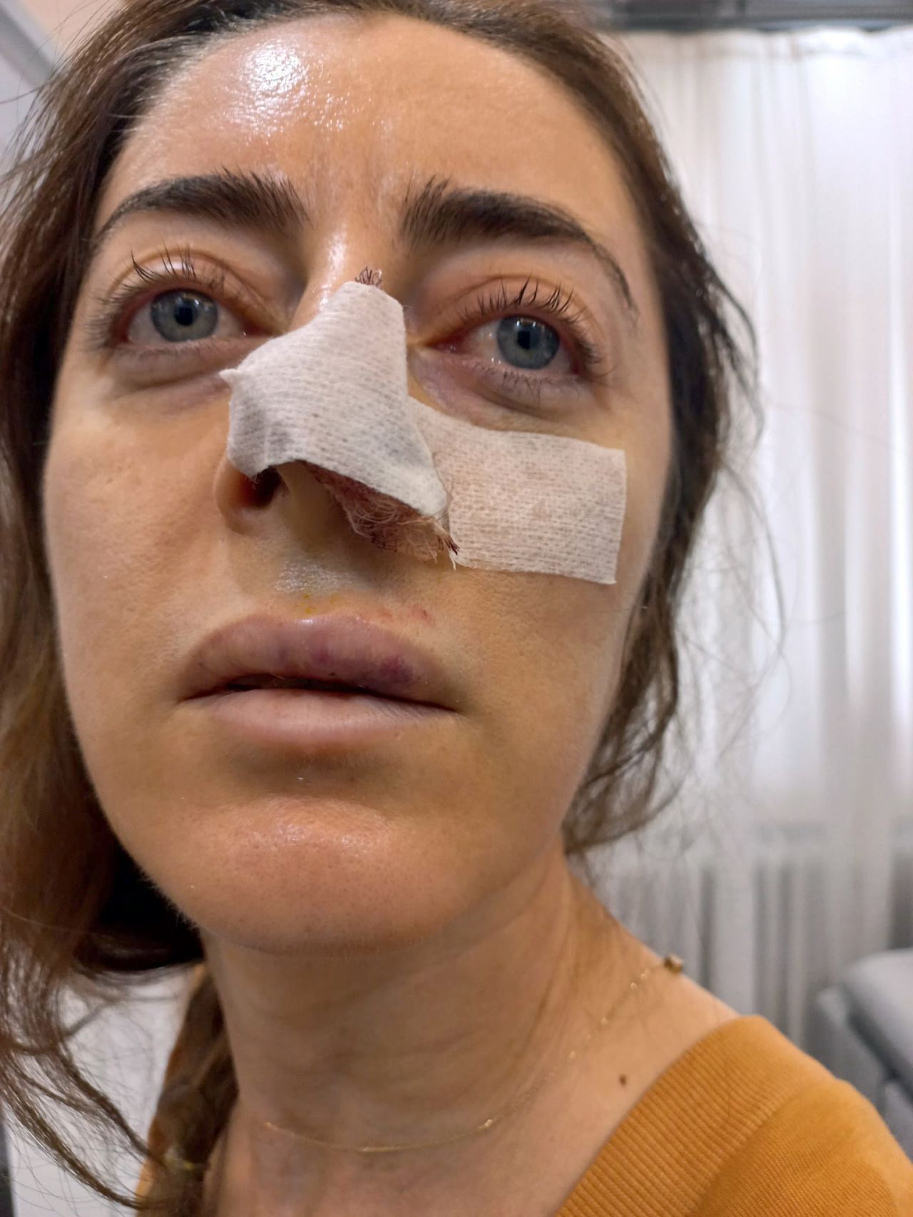 Sokakta gördüğü kadını eşinin sevgilisi sanınca bir anda saldırdı! Kafasını arabanın kapısına sıkıştırıp darp etti 3