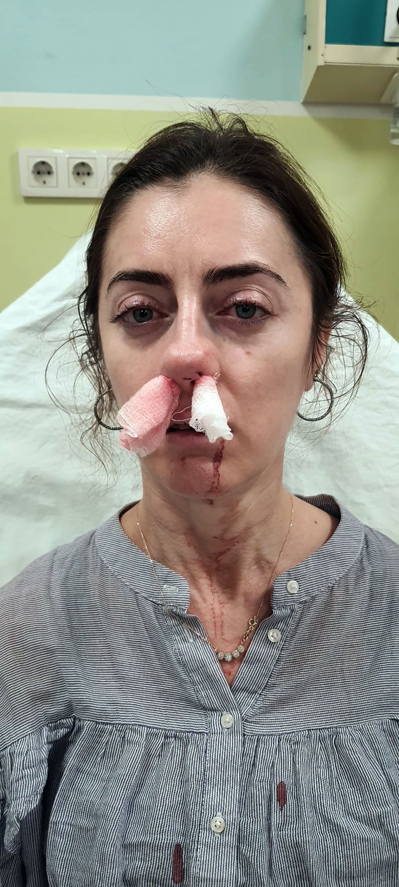 Sokakta gördüğü kadını eşinin sevgilisi sanınca bir anda saldırdı! Kafasını arabanın kapısına sıkıştırıp darp etti 4
