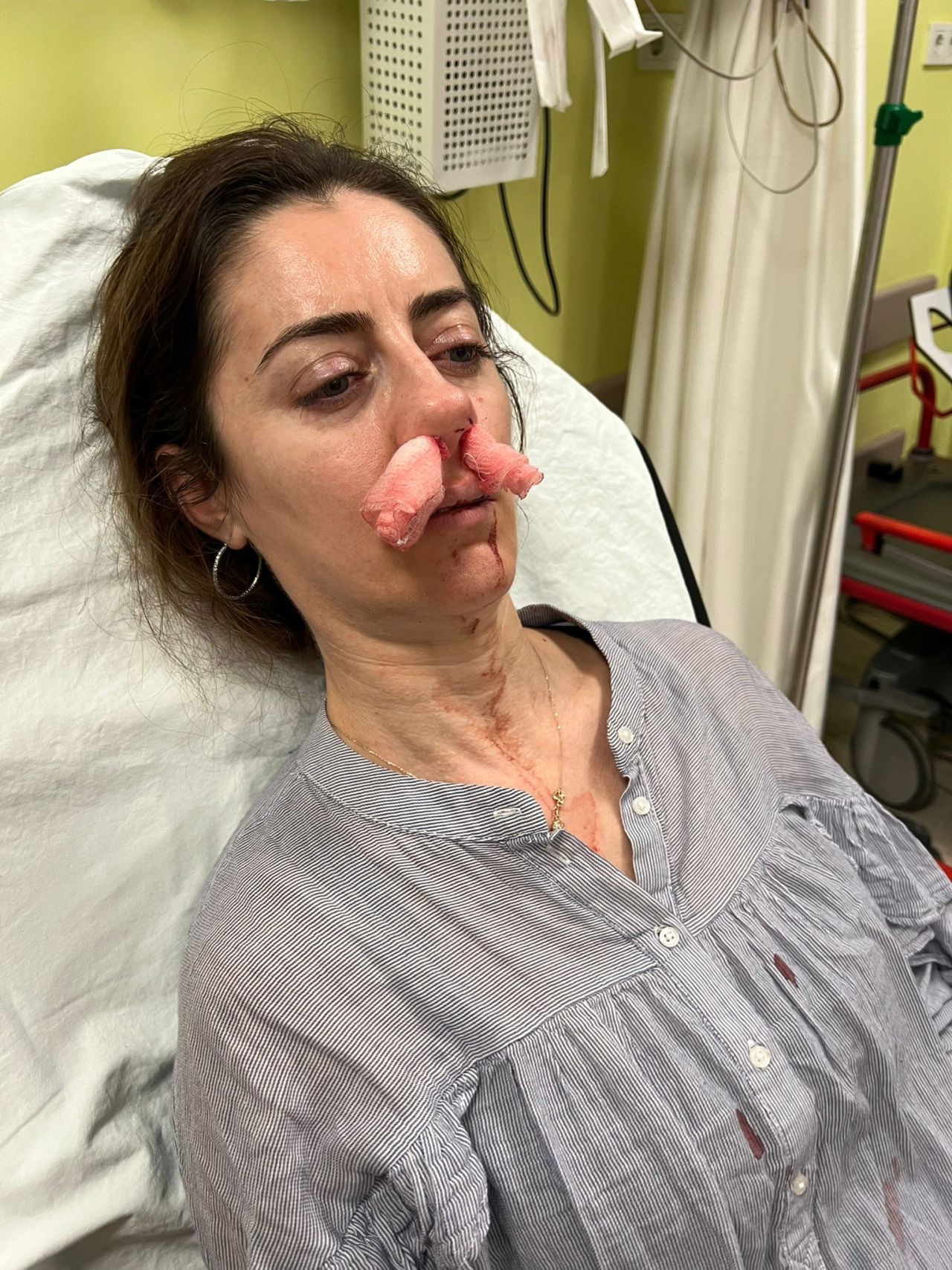Sokakta gördüğü kadını eşinin sevgilisi sanınca bir anda saldırdı! Kafasını arabanın kapısına sıkıştırıp darp etti 6