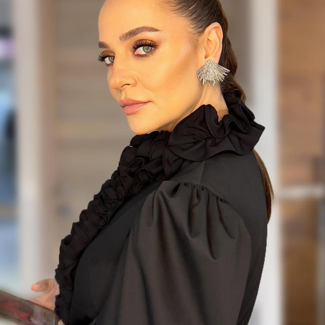 Didem Balçın sette kaza geçirdi! Apar topar hastaneye kaldırıldı: İşte Balçın'ın sağlık durumu 2
