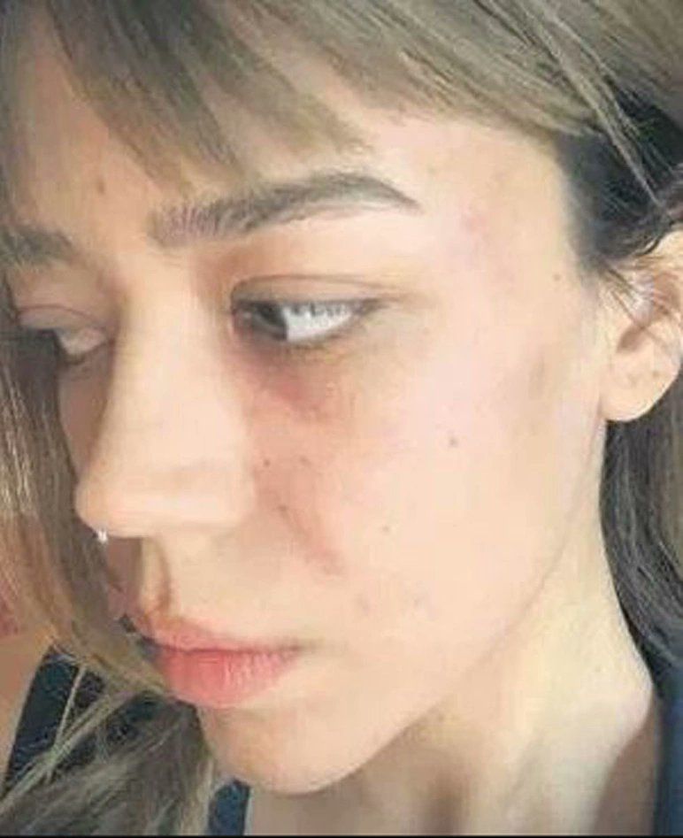 Feyza Aktan'dan Özcan Deniz itirafı: Beni dövmedi 3