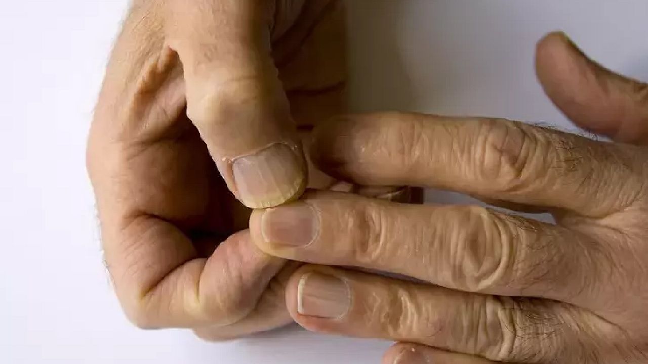 Tırnaklarınız biyolojik yaşınızı ele veriyor! Yavaş mı, hızlı mı yaşlanıyorsunuz? 1