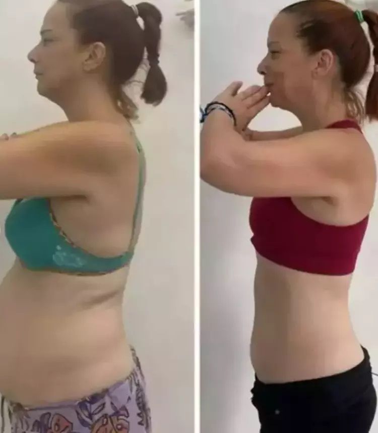 Yarım Elma’nın Yonca'sıydı! Janset Paçal’dan büyük değişim: 1,5 ayda 10 kilo verip imaj değiştirdi 4