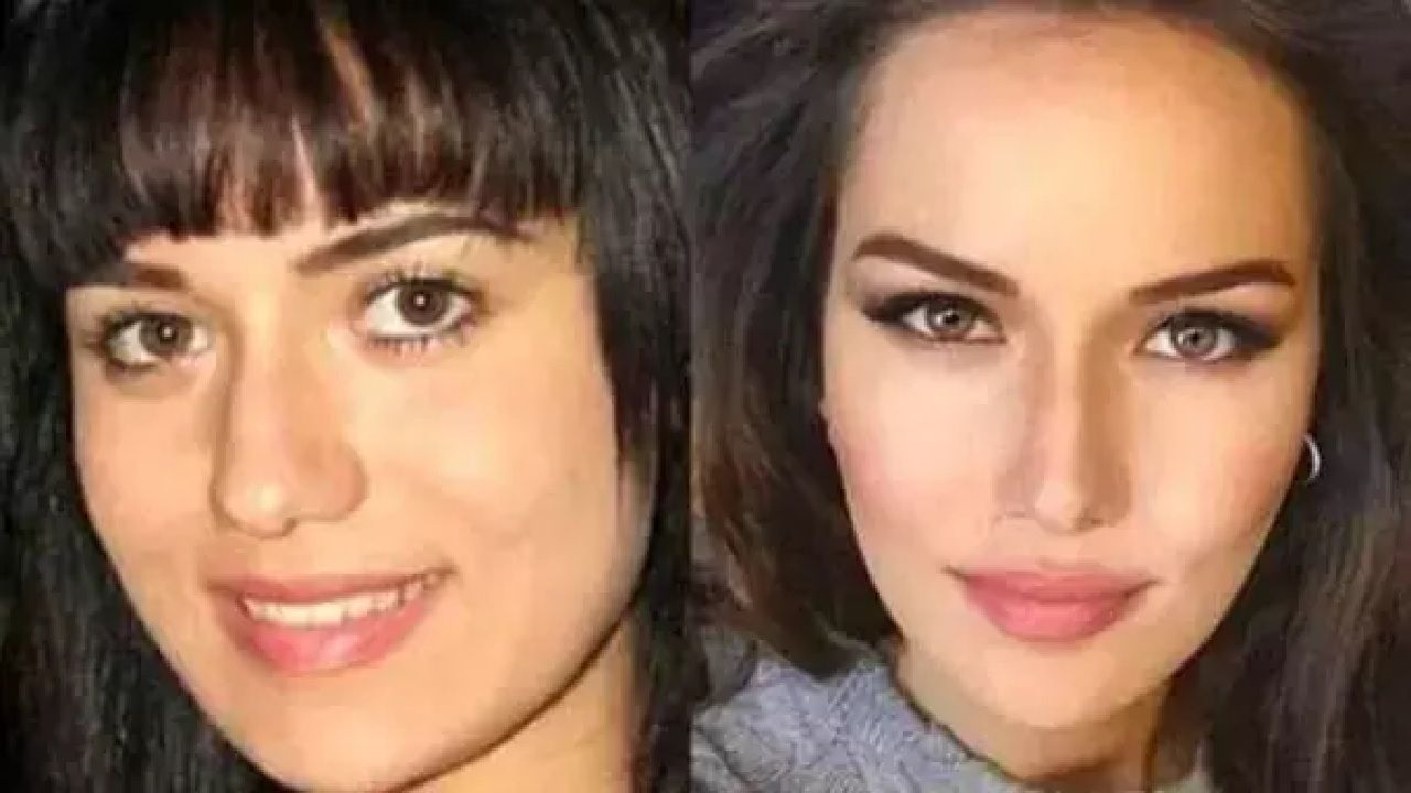Ünlülerin yıllar içindeki değişimine inanamayacaksınız! Sanki yıllar geçmemiş gibi! İşte ünlülerin estetikli halleri... 2