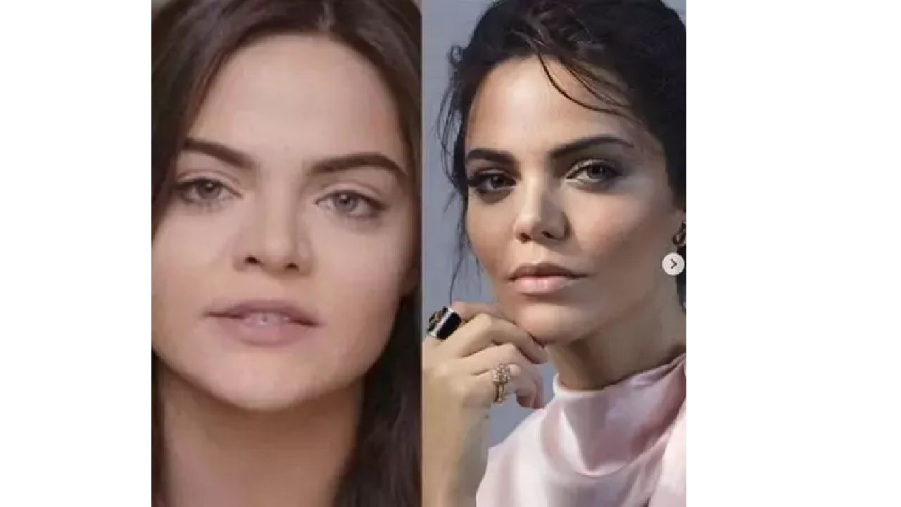 Ünlülerin yıllar içindeki değişimine inanamayacaksınız! Sanki yıllar geçmemiş gibi! İşte ünlülerin estetikli halleri... 3