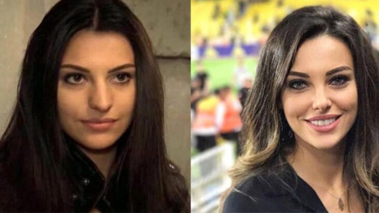 Ünlülerin yıllar içindeki değişimine inanamayacaksınız! Sanki yıllar geçmemiş gibi! İşte ünlülerin estetikli halleri... 5