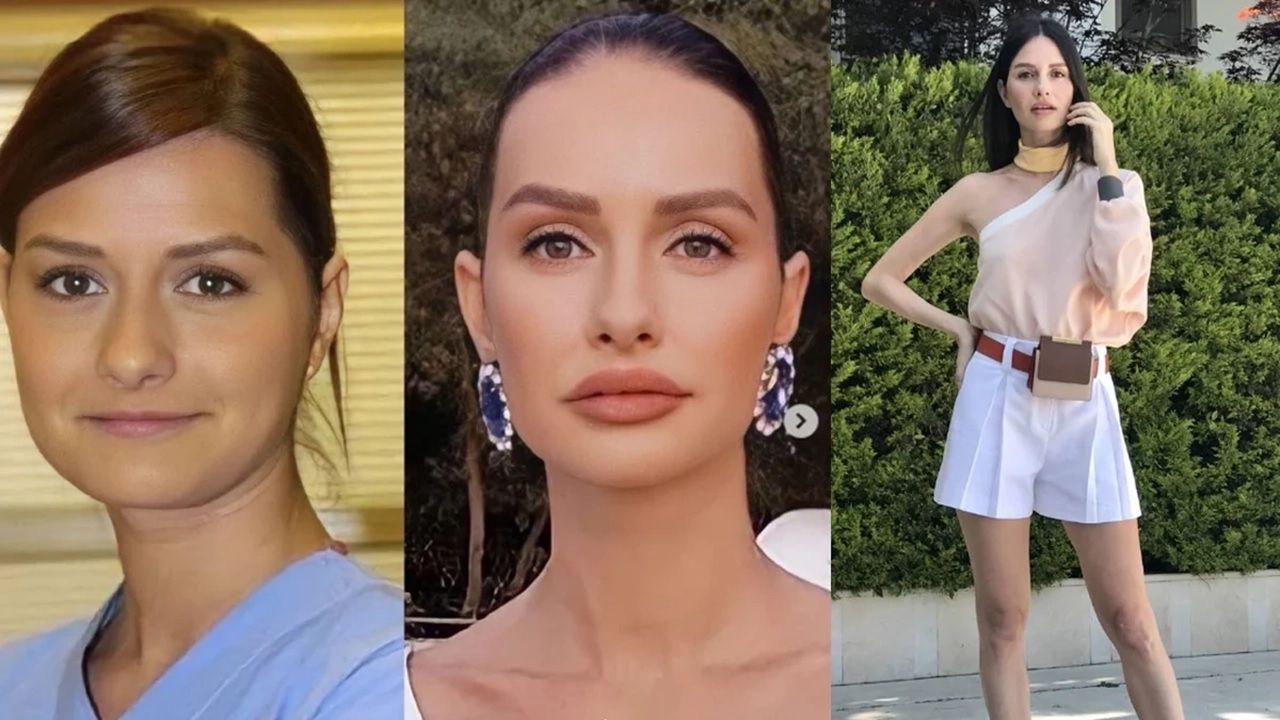 Yasemin Özilhan'dan estetik itirafı: "Sadece dudağımda dolgu var!" 2