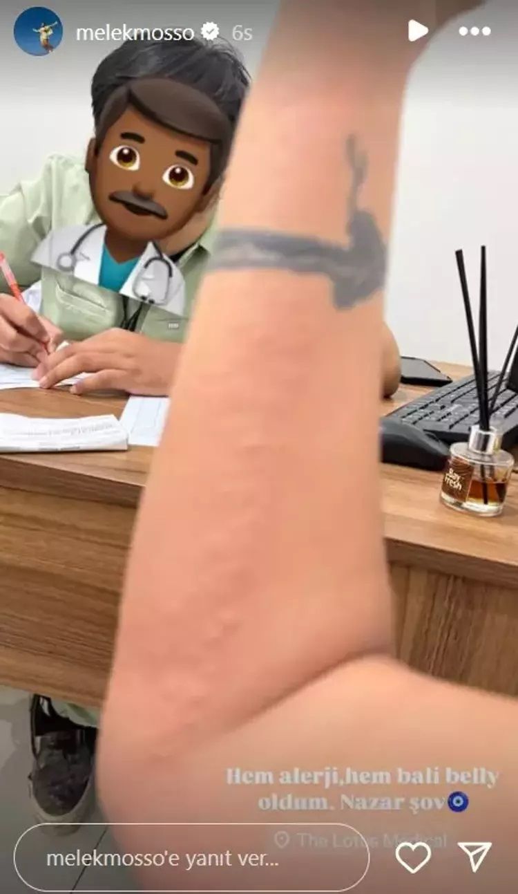 Melek Mosso’nun Bali tatili kabusa döndü: Hastanelik oldu, görüntüler korkuttu! 4
