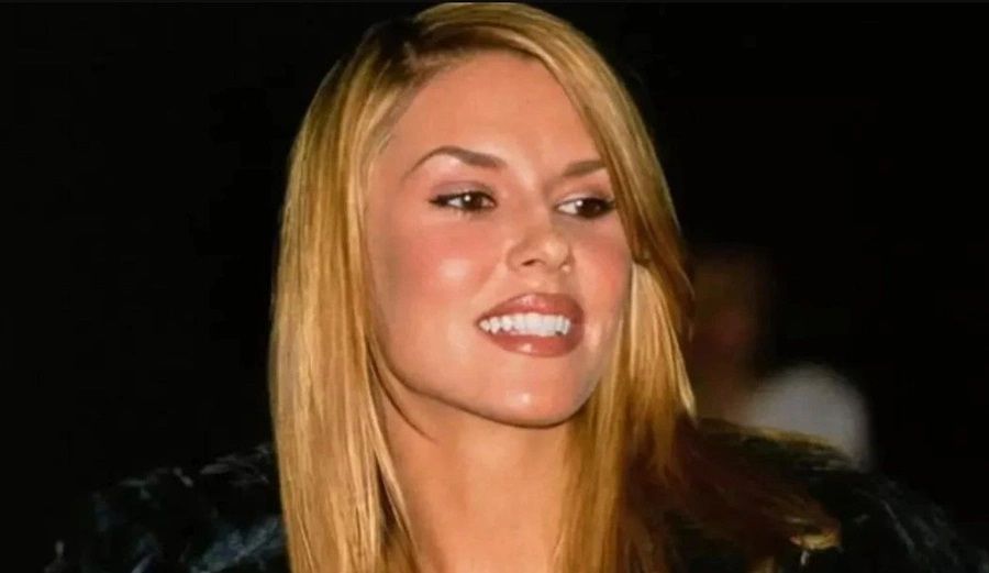 Estetik ve makyaj tutkusu Brandi Glanville'nin kabusu oldu! Suratında mantar ve parazit oluşan ünlü modelin son hali şaşkına çevirdi 1