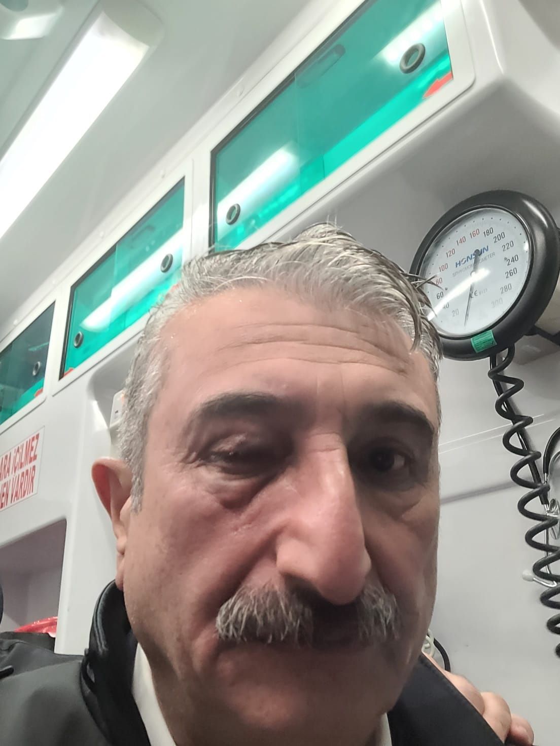 Bursa'daki Ekrem İmamoğlu eylemlerinde CHP İl Başkanı gözünden yaralandı 6