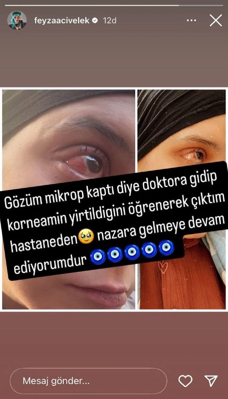 Gözüne kan gelen Feyza Civelek, doktora gidince gerçeği öğrendi! 3