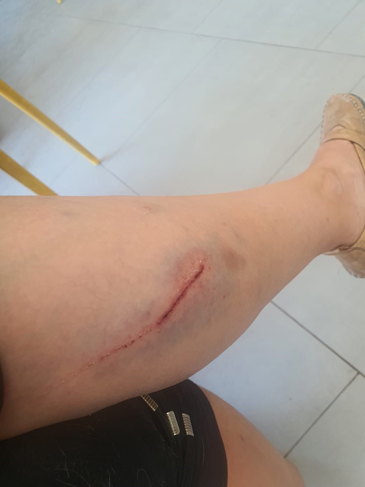 Bursa'da kangal dehşeti! Köpeğini gezdiren kadın paramparça ettiler; o anlar kamerada 2
