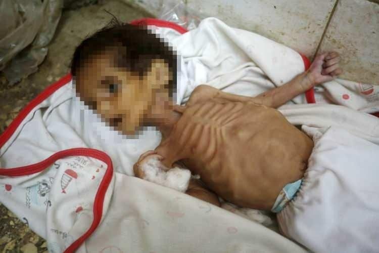 Yürekleri yakan haber! Gazze'de 3 aylık Curi bebek açlıktan öldü! 3