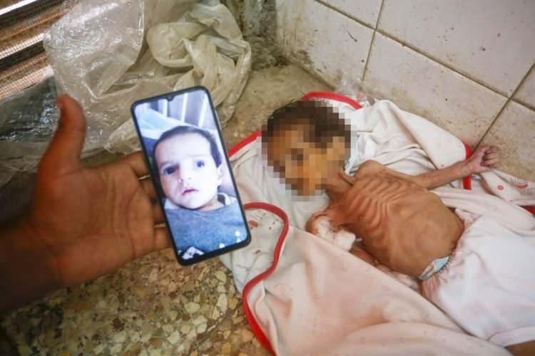 Yürekleri yakan haber! Gazze'de 3 aylık Curi bebek açlıktan öldü! 5
