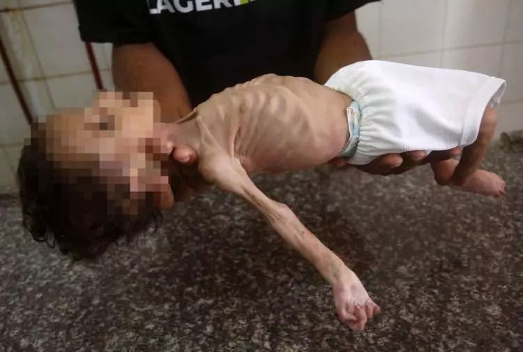 Yürekleri yakan haber! Gazze'de 3 aylık Curi bebek açlıktan öldü! 8