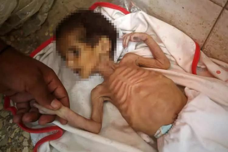 Yürekleri yakan haber! Gazze'de 3 aylık Curi bebek açlıktan öldü! 12