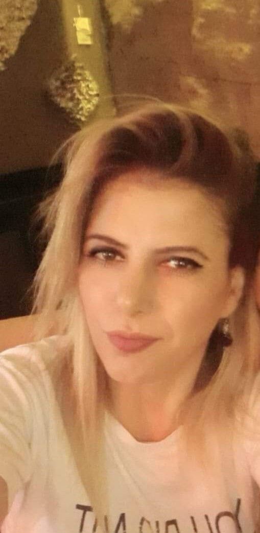 Eski sevgilisi uyurken yüzüne kezzap attı! Yıkayamasın diye evin suyunu kesmiş... 7