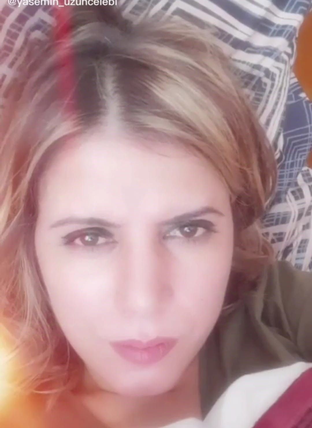 Eski sevgilisi uyurken yüzüne kezzap attı! Yıkayamasın diye evin suyunu kesmiş... 9