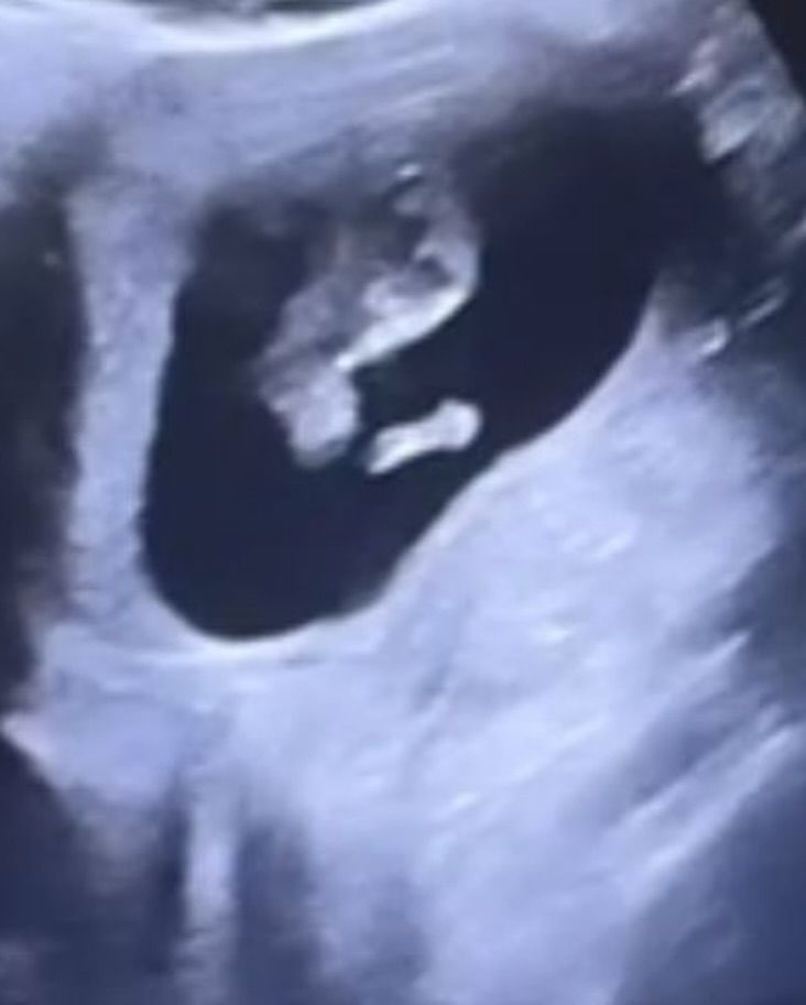 Ünlü oyuncu Beste Kökdemir, düğün gününde bebek müjdesi verdi 3