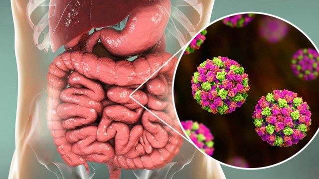 Meclis'ten tüm Türkiye'ye yayıldı: Kusma ve ishal salgını büyüyor, uzmanlardan şebeke suyu uyarısı! 4