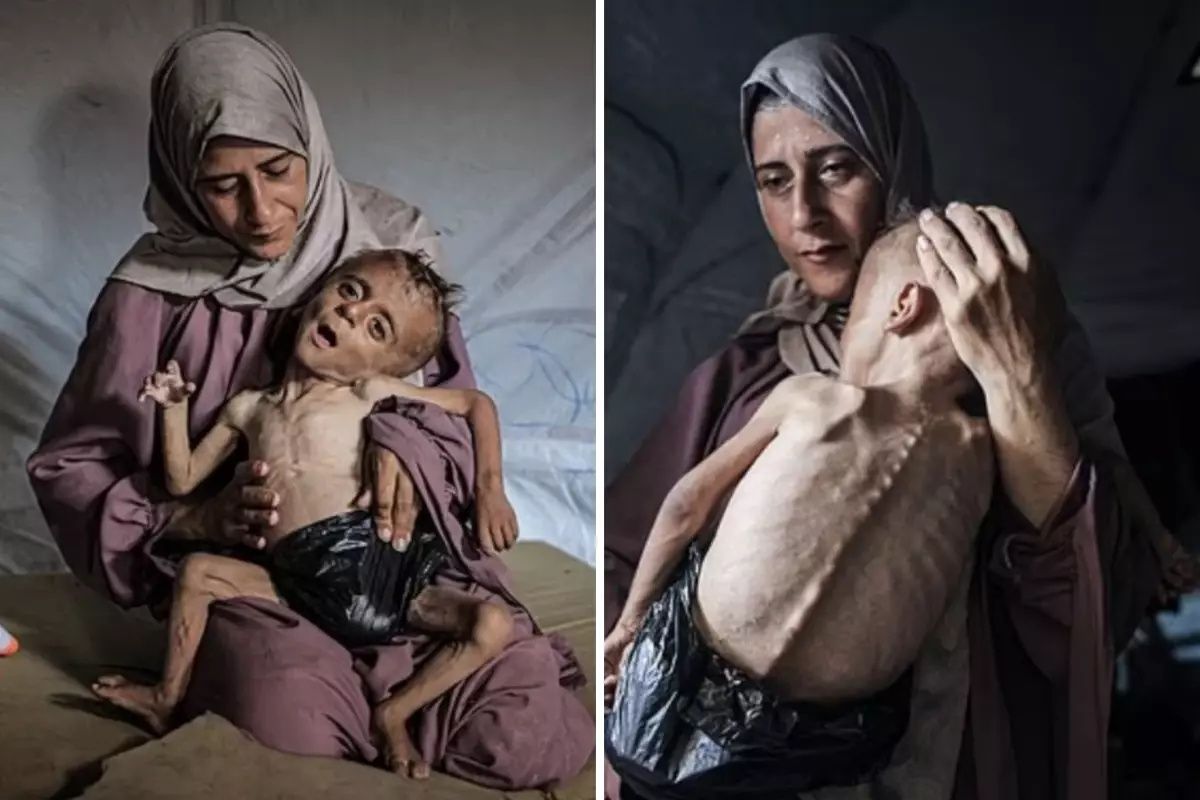 Bu bir fotoğraf değil, feryat! Gazze'de açlıktan ölmek üzere olan Muhammed bebeğin çığlığına dünya sağır! 1