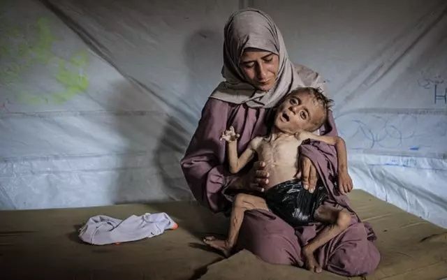 Bu bir fotoğraf değil, feryat! Gazze'de açlıktan ölmek üzere olan Muhammed bebeğin çığlığına dünya sağır! 4