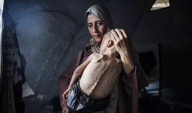 Bu bir fotoğraf değil, feryat! Gazze'de açlıktan ölmek üzere olan Muhammed bebeğin çığlığına dünya sağır! 5