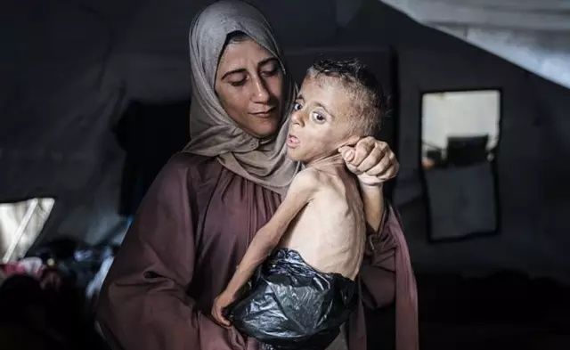 Bu bir fotoğraf değil, feryat! Gazze'de açlıktan ölmek üzere olan Muhammed bebeğin çığlığına dünya sağır! 3