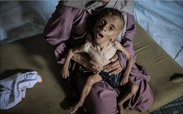 Bu bir fotoğraf değil, feryat! Gazze'de açlıktan ölmek üzere olan Muhammed bebeğin çığlığına dünya sağır! 2
