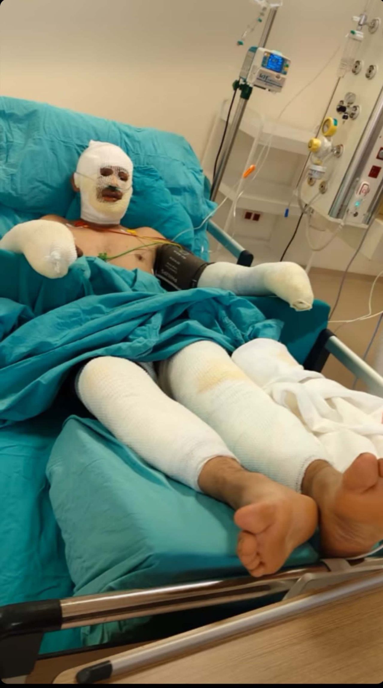 Seyitgazi yangınında ağır yaralanan kahraman ormancı Kader Dereli'nin son halini eşi paylaştı 6