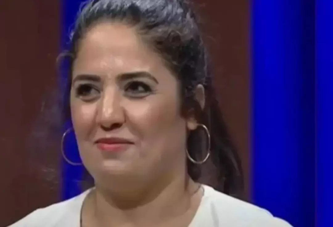 Azize Polat’ın MasterChef sonrası değişimi görenleri şaşırttı! Estetik operasyonlarla bambaşka biri oldu 2