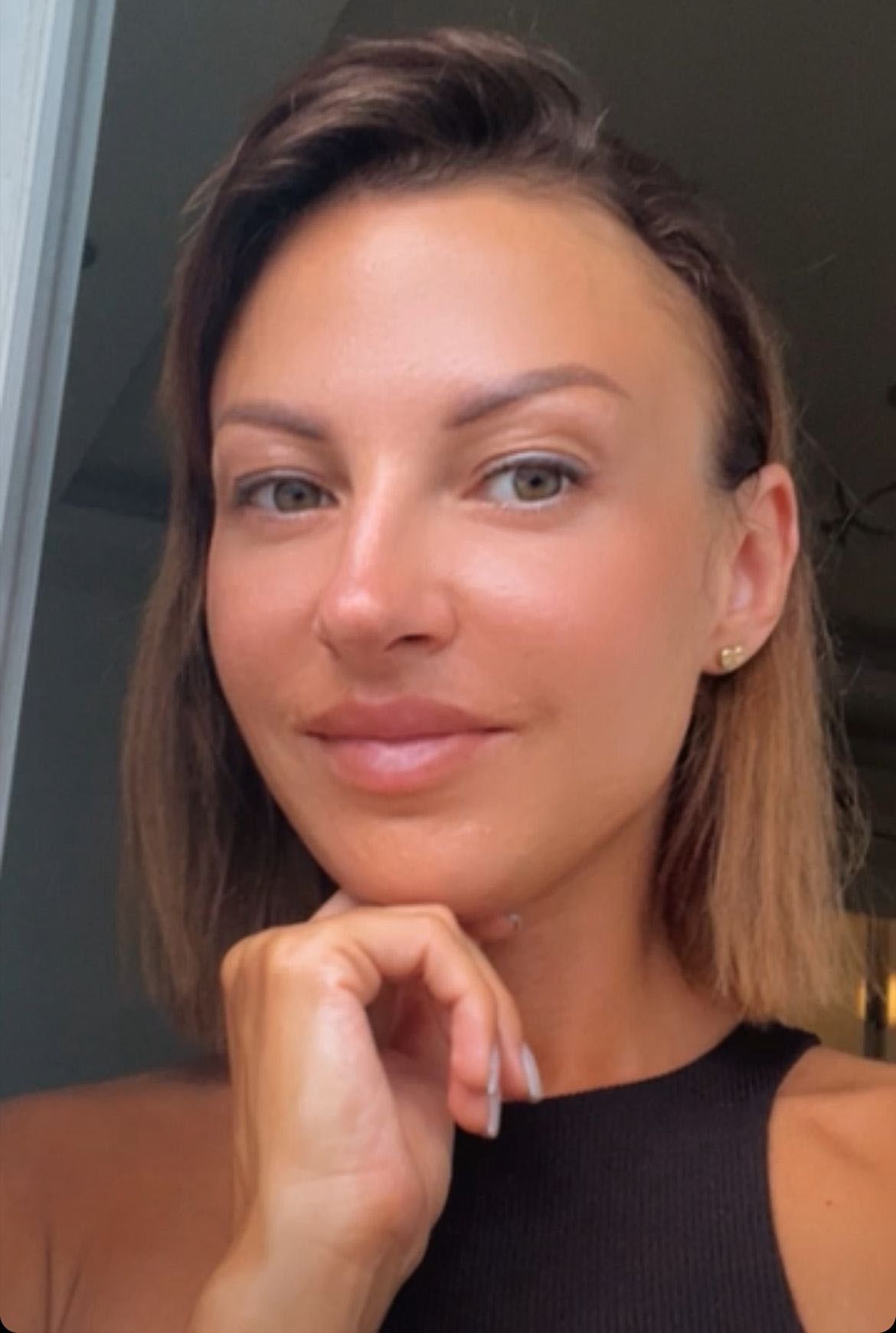Ukraynalı eski eşi Irina'ya sopayla saldırdı, hastanelik etti! "Öldüreceğim" diyerek defalarca vurdu 3
