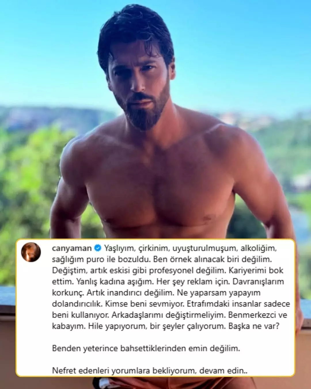 Can Yaman'dan çarpıcı paylaşım! "Yaşlıyım, çirkinim, alkoliğim, sağlığım bozuldu" 2