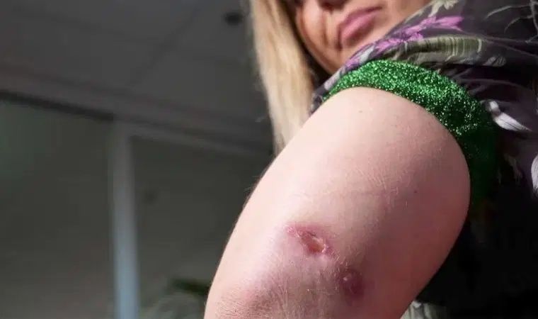 Et yiyen bakteri paniği! Sağlık Bakanlığı’ndan ‘Vibrio’ açıklaması: Türkiye’de vaka tespit edilmedi 4