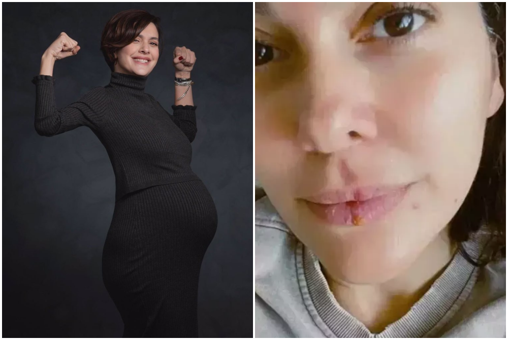 Stres, kaygı ve bastırılmış duygularıyla mücadele eden Bergüzar Korel'den dikkat çeken paylaşım! 2