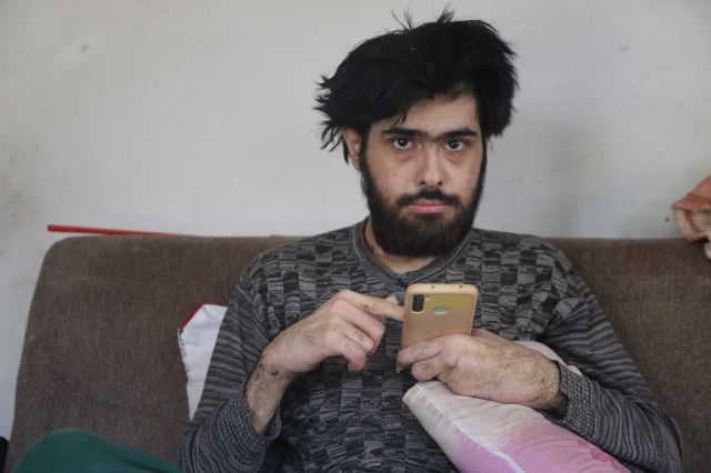 3 yıldır evden çıkmayan, banyo yapmayan Barış Özbay'ın eski hali ortaya çıktı... "Eskiden çok bakımlıydı..." 1