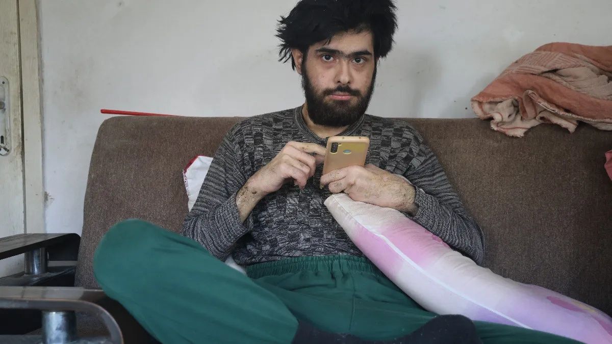 3 yıldır banyo yapmayan, evden çıkmayan Barış Özbay'ın hastalığı belli oldu: Anksiyete ve depresyon! 8