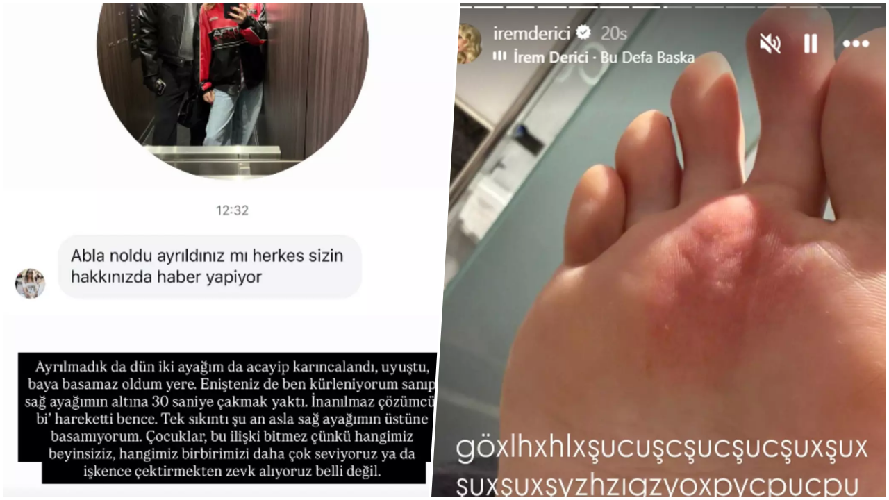 İrem Derici sevgilisinden ayrıldı mı? 'Ayağımın altına çakmak yaktı' deyip fotoğrafını paylaştı 4