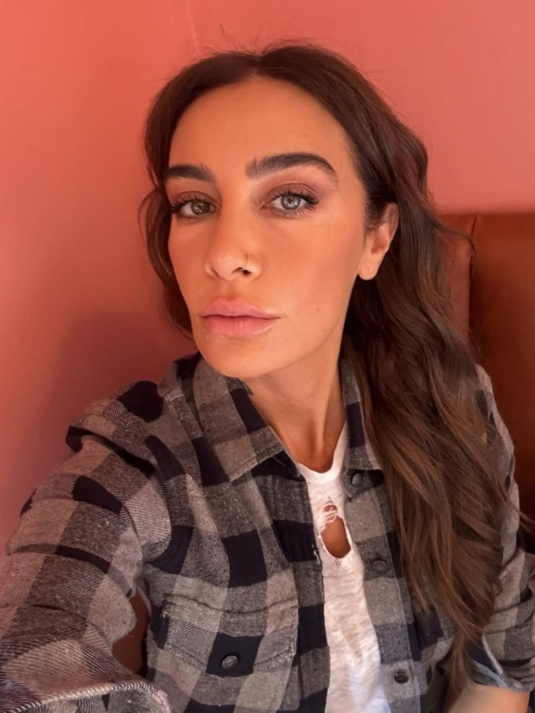 Estetik yaptıran Sıla Gençoğlu, son haliyle İrem Derici'ye benzetildi! 4