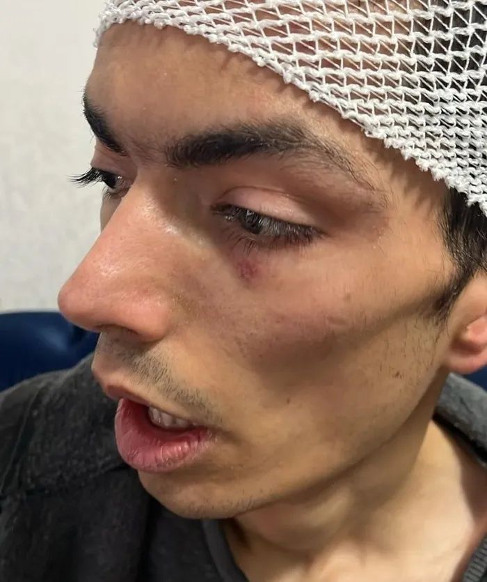 Gaziantep’te vicdanları yaralayan iddia! Engelli bakım merkezinde ne oldu? 28 yaşındaki genç darp edildi, 6 dikiş atıldı... 5