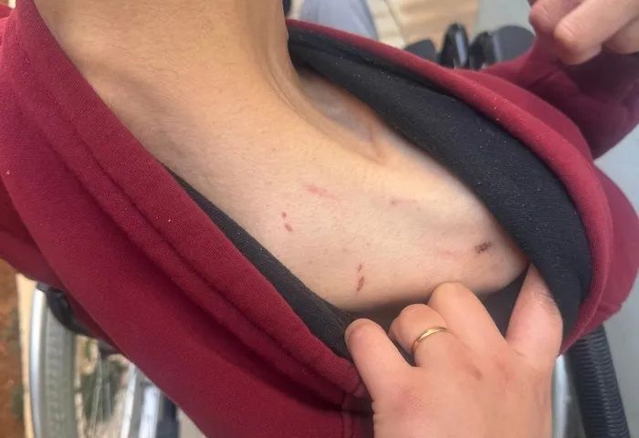 Gaziantep’te vicdanları yaralayan iddia! Engelli bakım merkezinde ne oldu? 28 yaşındaki genç darp edildi, 6 dikiş atıldı... 3