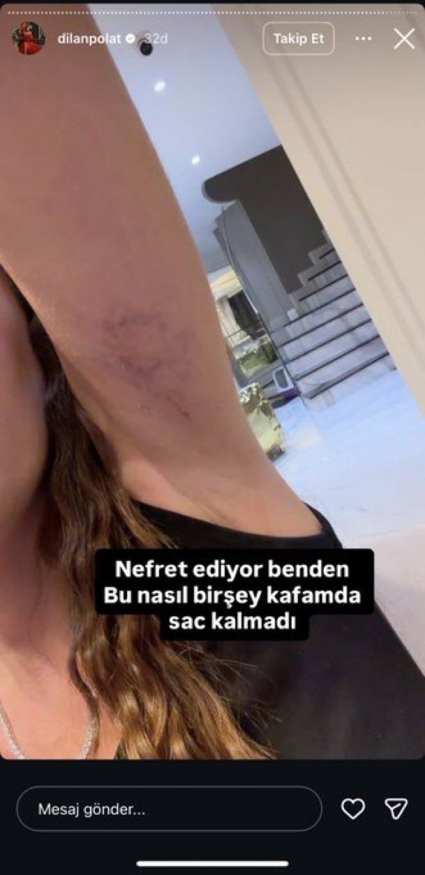 Dilan Polat, ablası Sıla Doğu'dan dayak yedi! Saç saça baş başa kavga... "Benim böyle bir kardeşim yok" 3