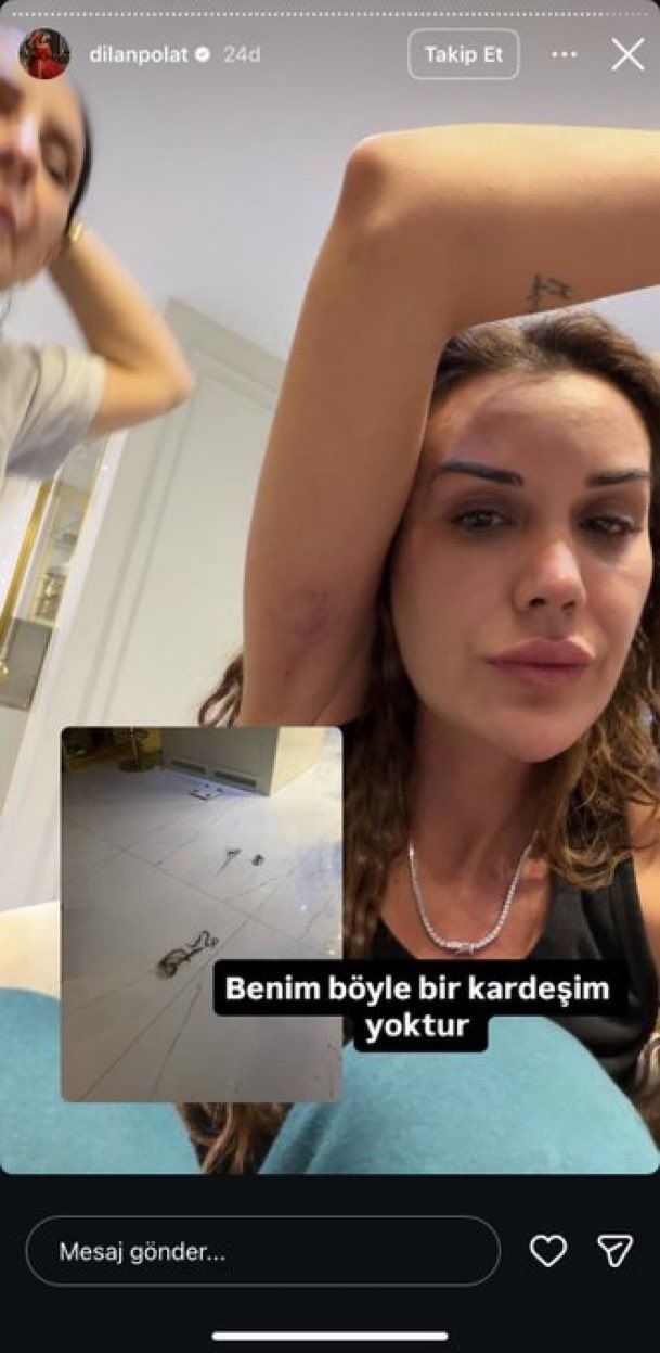 Dilan Polat, ablası Sıla Doğu'dan dayak yedi! Saç saça baş başa kavga... "Benim böyle bir kardeşim yok" 4