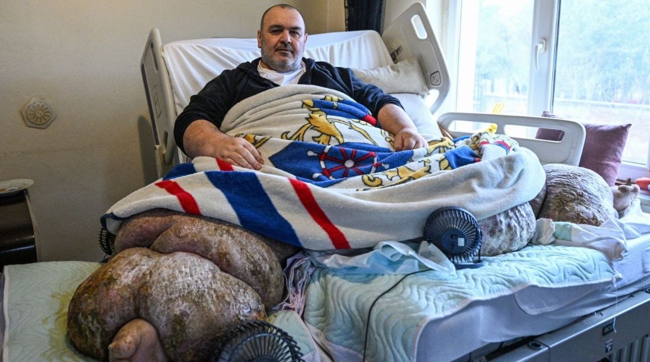 Kayseri'de 300 kiloluk fil hastası, özel ekiple hastaneye taşındı 3