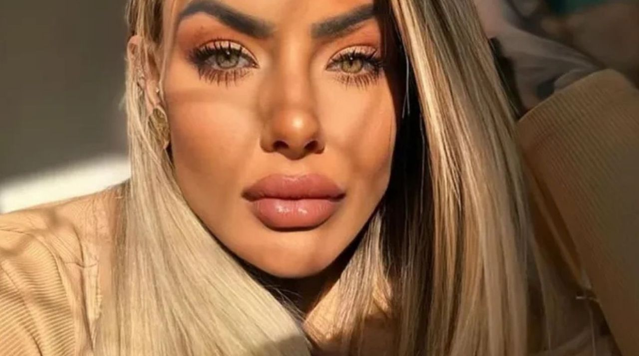 Bianca Dias kimdir? Estetik operasyon geçiren fenomen neden öldü? 6