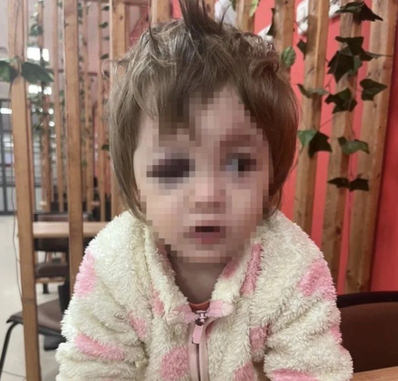 Türkiye, Yalova'daki komşu dehşetini konuşuyor! 14 aylık bebeği ve babasını sopayla darbetti! Bakan Gürlek duruma el koydu: Süreç titizlikle takip ediliyor! 2