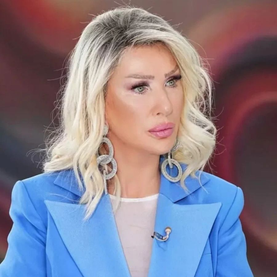 Seda Sayan'ın son hali şaşırttı! Yine mi estetik... 4